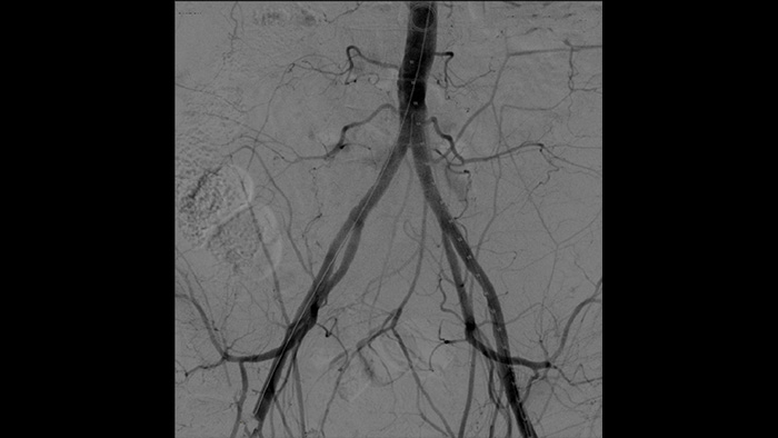 Processamento vascular