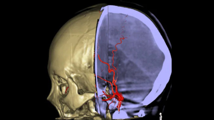 Navega&ccedil;&atilde;o 3D precisa do Roteiro SmartCT