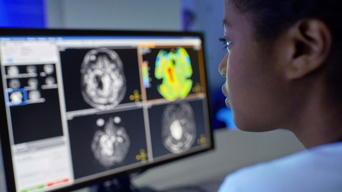Aplica&ccedil;&otilde;es em diagn&oacute;stico por imagem de estudos cerebrais 